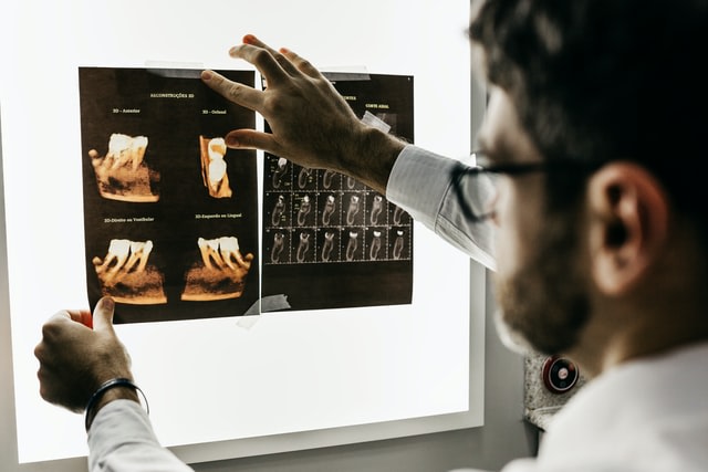 Dentista esamina radiografia di denti con ponti dentali