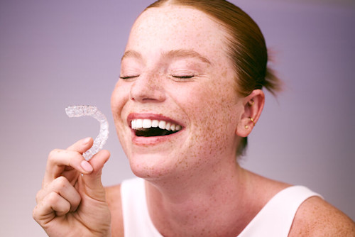 Wie läuft die DR SMILE X Impress Behandlung ab?