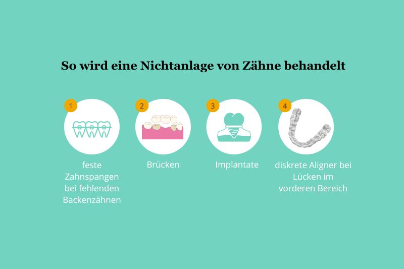 Wie wird eine Hypodontie behandelt?