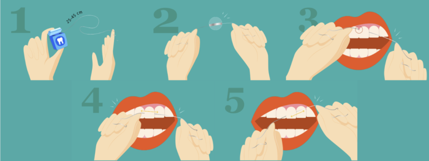 Comment utiliser du fil dentaire, un guide illustré par DR SMILE