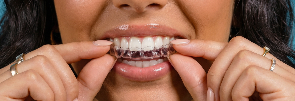 [CRO] During the treatment Impress Hero Desktop