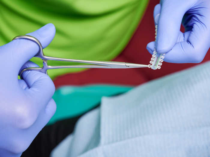Ortodoncista cortando gomas de la ortodoncia