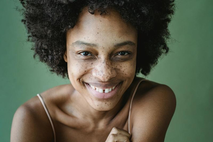 Frau mit Diastema @ pexels von antonius-ferret