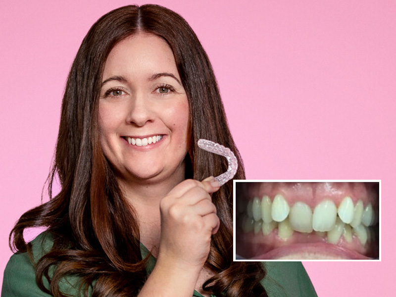 Mujer con sobremorida