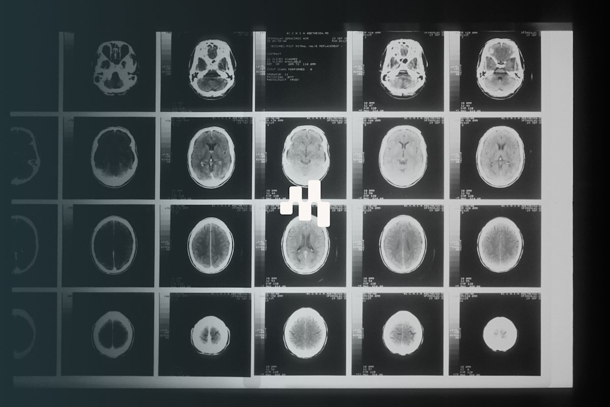 agentic‑ai‑automation‑clinical‑operations