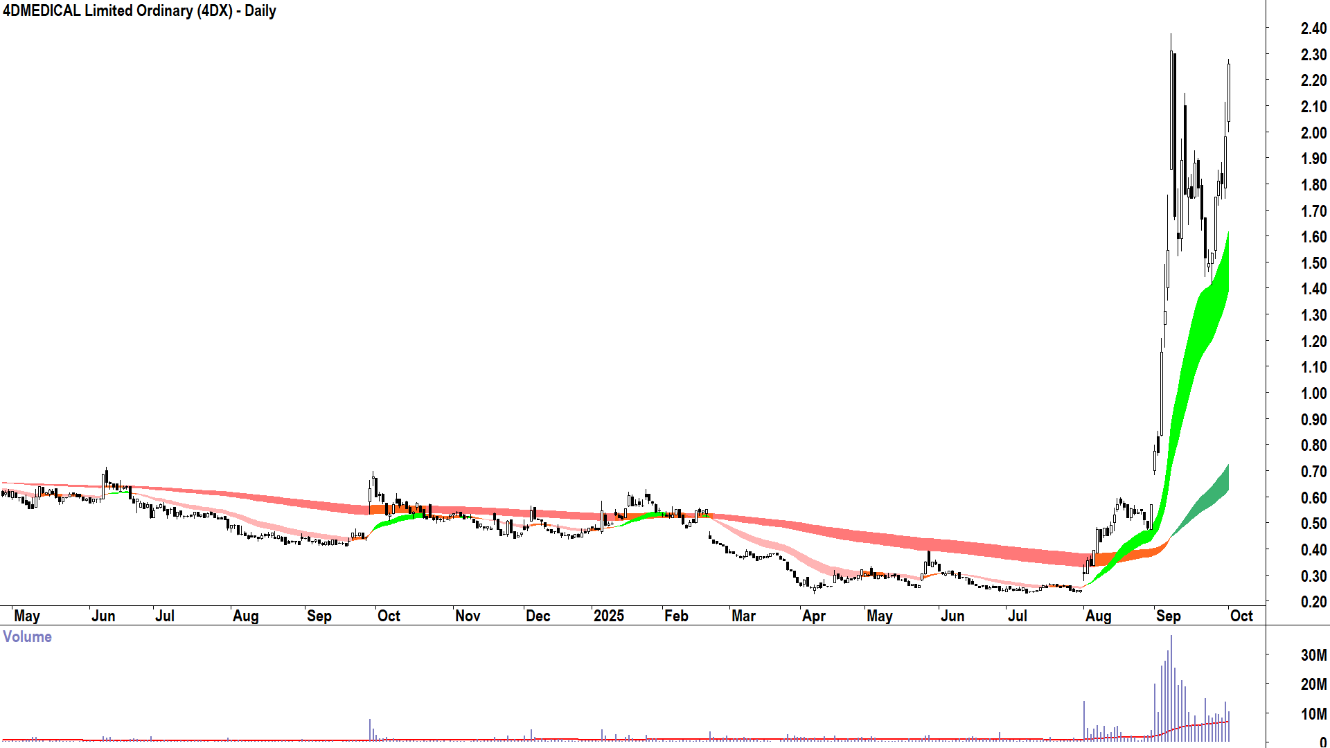4DMEDICAL (ASX-4DX) daily chart 1 October 2025