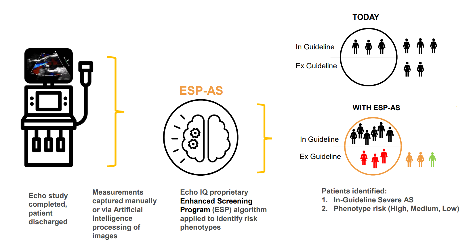 An infographic depicting a flowchart process of Echo IQ's detection software 