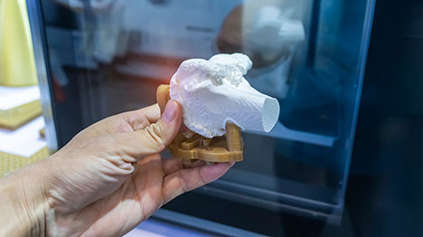 How Additive Manufacturing Is Revolutionizing Medical Implants