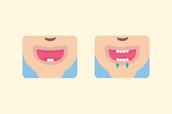 Cómo limpiar los dientes de tú bebé