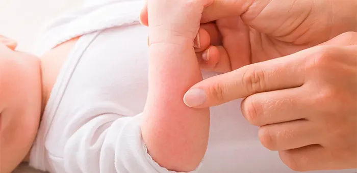 Mamá toca a su bebé. Remedios para la alergia.