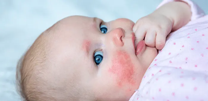 Llega el frío! Cómo evitar que el frío afecte a tu bebé - Más Pañales