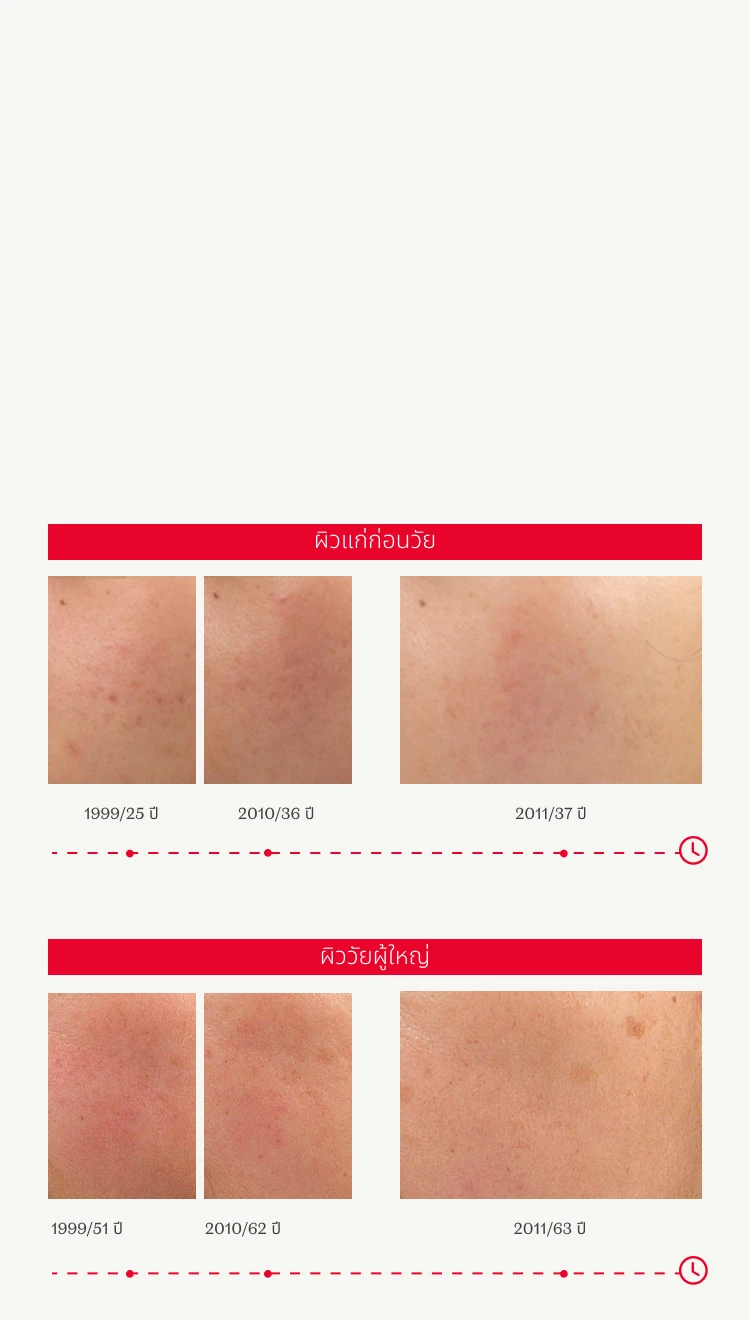 PBC Anti-aging Section Image