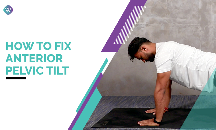 How to Fix Anterior Pelvic Tilt