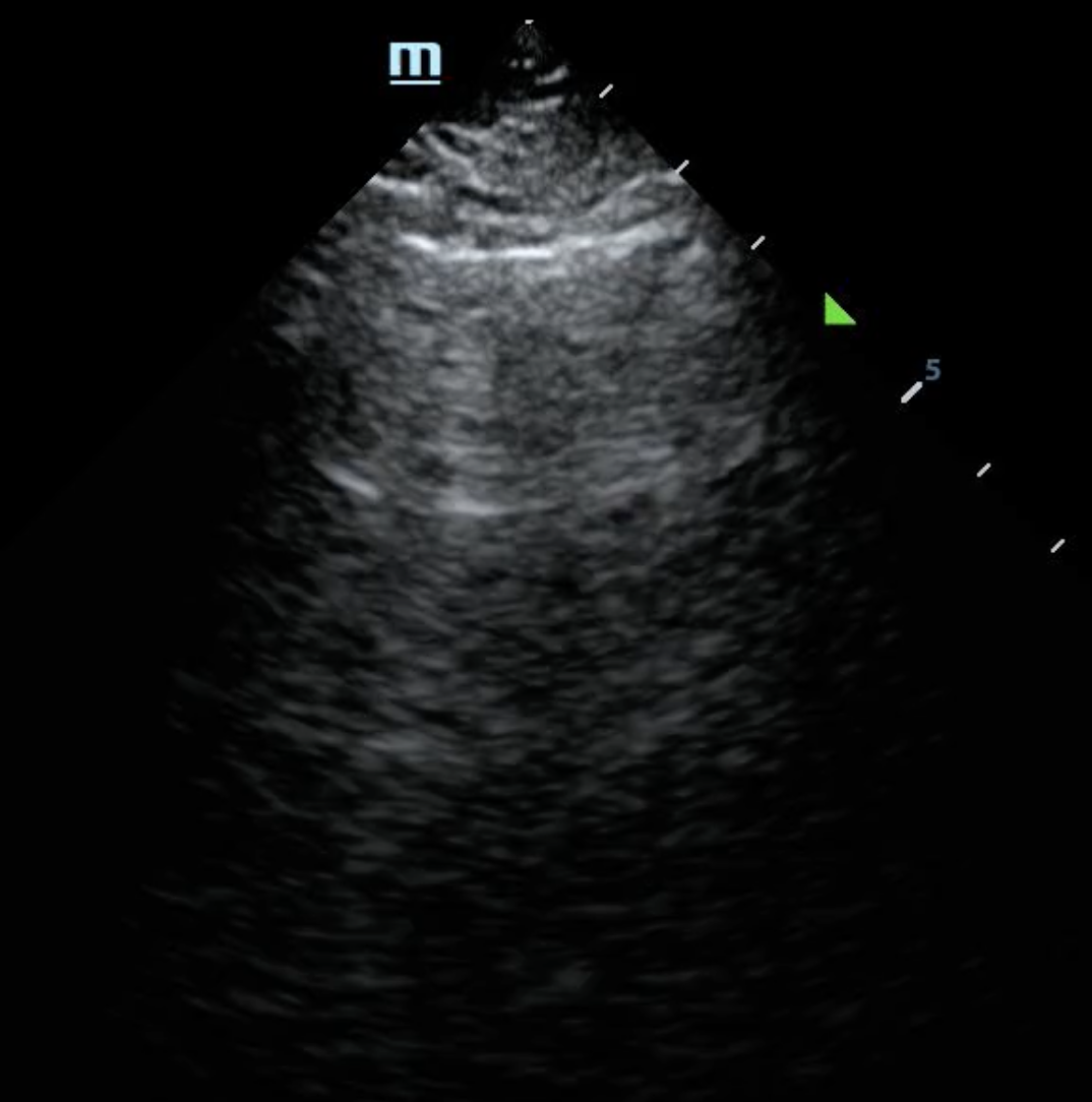 Cover Image for Bedside deployment of lung ultrasound by nurses - a new frontier of front-line diagnostics 