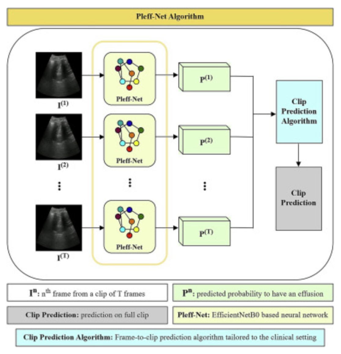 Cover Image for Bridging the Gap - AI’s Role in Enhancing Lung Ultrasound Accuracy