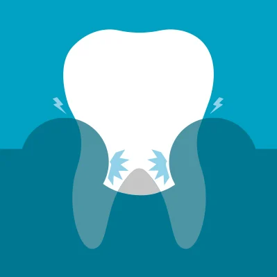 symptoms-of-gum-problems-2.jpg
