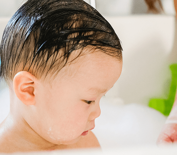 baby skin care tips