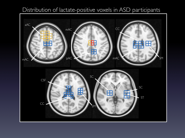 a diagram of distribution of lactate-positive voxels in participants with autism