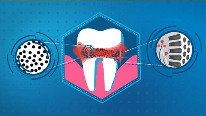 What Is Tooth Sensitivity And Exposed Dentin? 