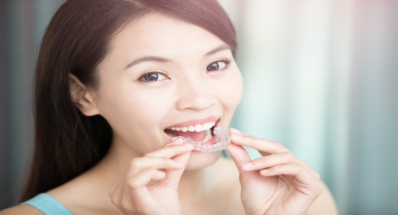 Adult Braces: A Complete Guide On Types Of Braces | Oral -B IN