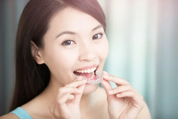 Clear Aligners article banner