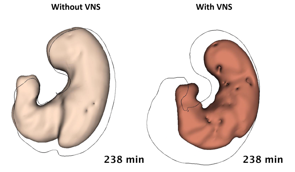 The effect of vagus nerve stimulation on gastric emptying in rats from our earlier animal studies