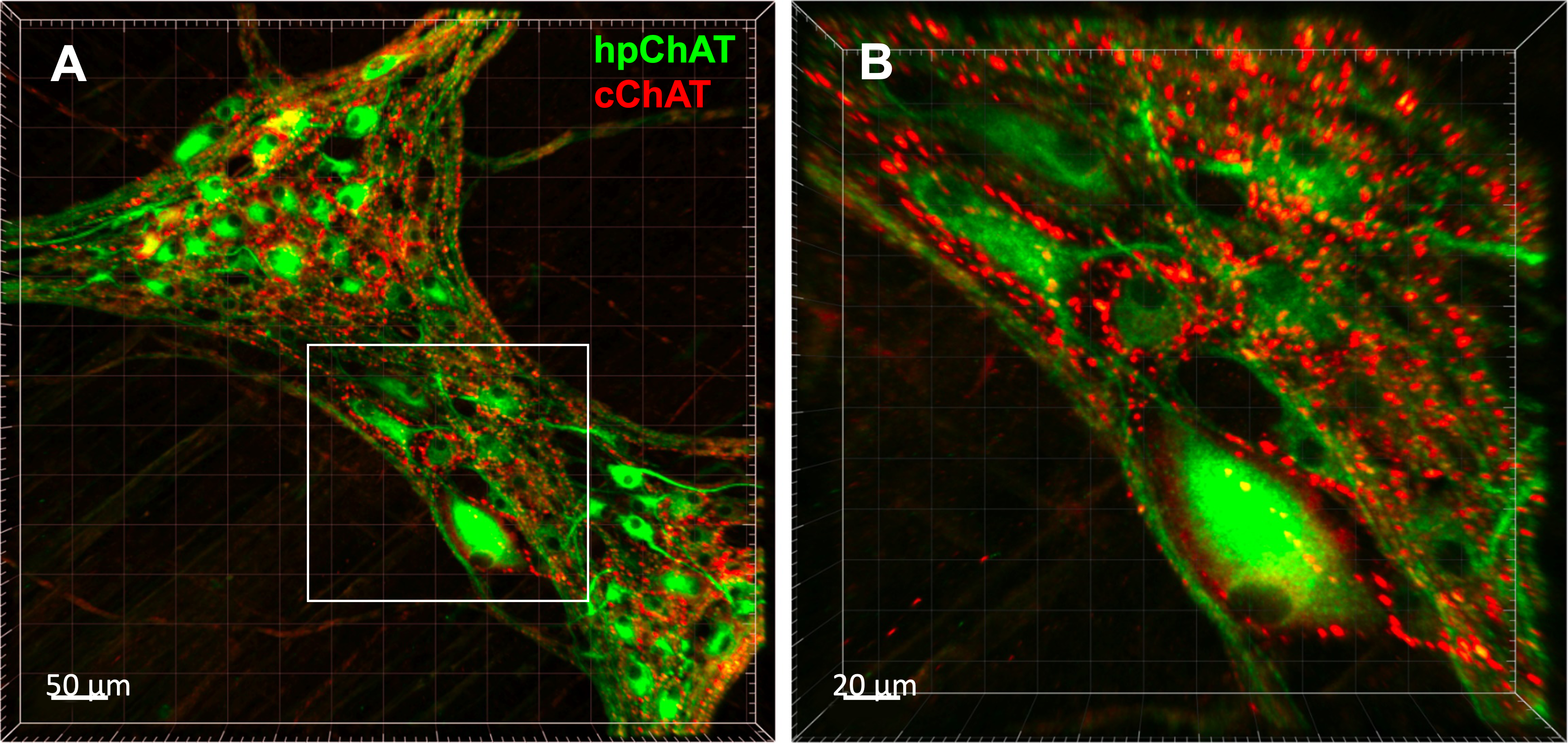 Exploring the brain-gut connection via cholinergic pathway Figure 2