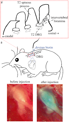 STORY figure 4