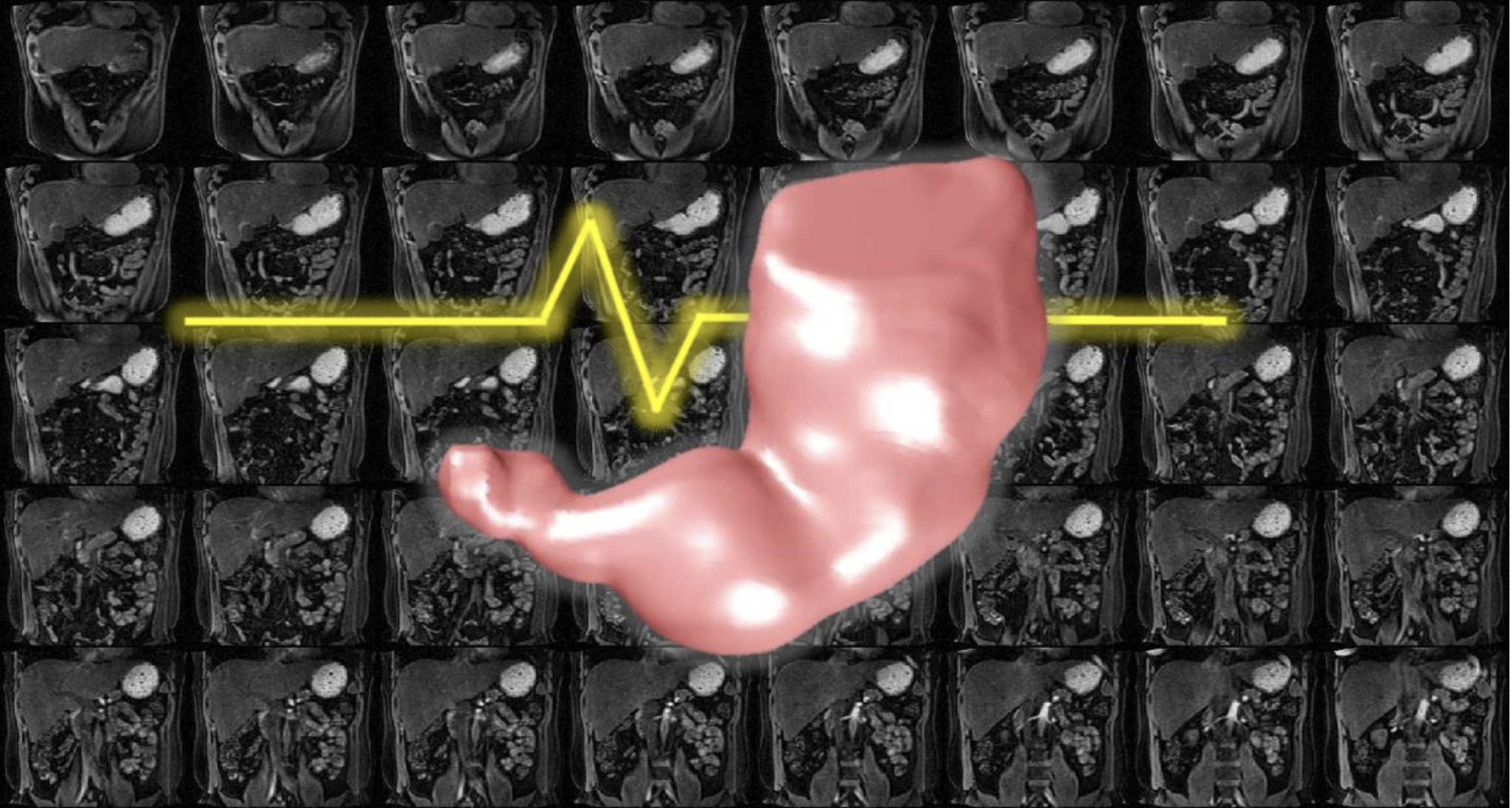 A new MRI technique helps scientists to understand how the stomach responds to nutrients and therapies, which could offer more precise treatment for digestive disorders.