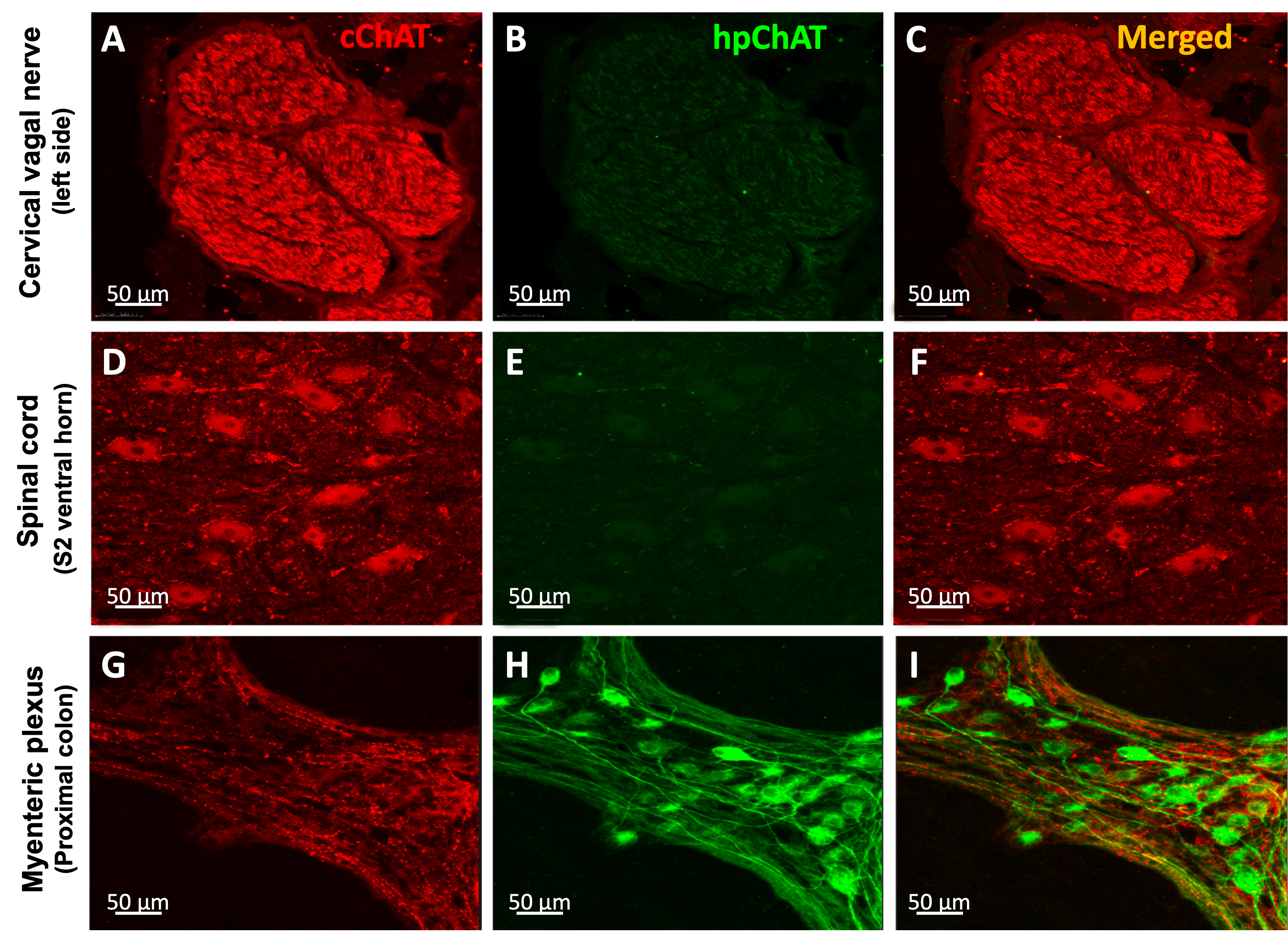 Exploring the brain-gut connection via cholinergic pathway Figure 1