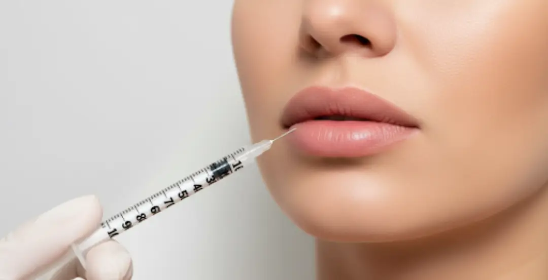 How Many Syringes for Lip Filler?