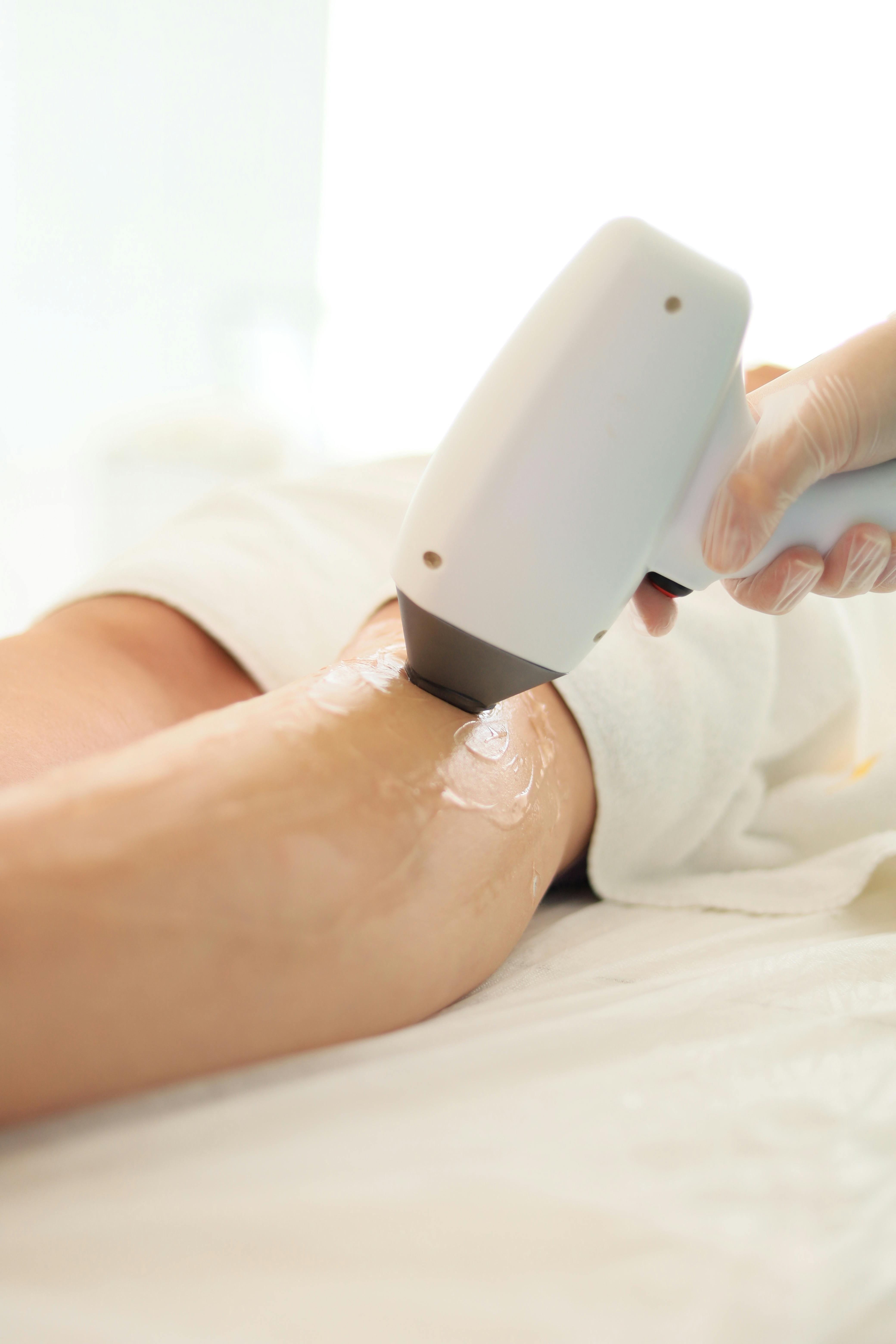 Is Laser Hair Removal Better Than Waxing or Shaving?