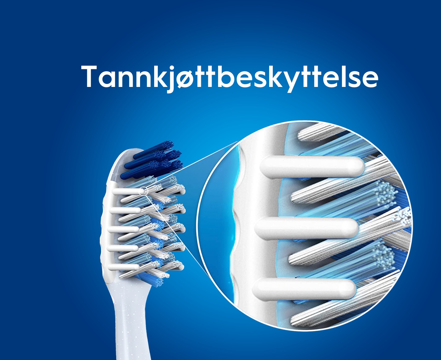 Tannkjøttbeskyttelse