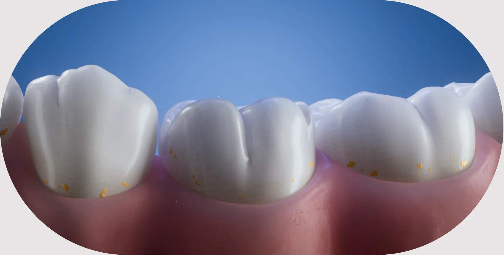 Protect Your Gums 