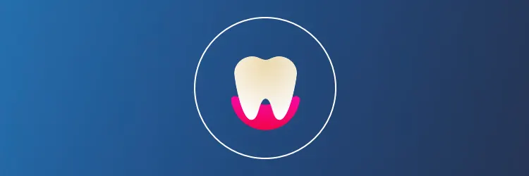 Er tannimplantat riktig løsning for deg? article banner