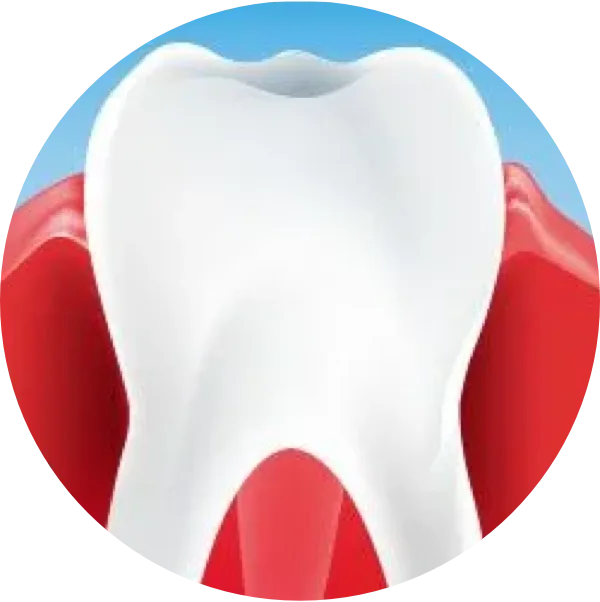 Hva forårsaker artikkel om tannkjøttsykdommer