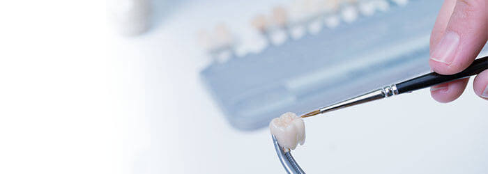Hvordan fungerer en tannkrone? | Oral-B article banner