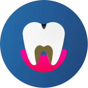 Behandling av hull: Måter å behandle hull på