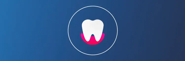 Oppretthold riktig munnhygiene for å forhindre metallisk smak i munnen article banner