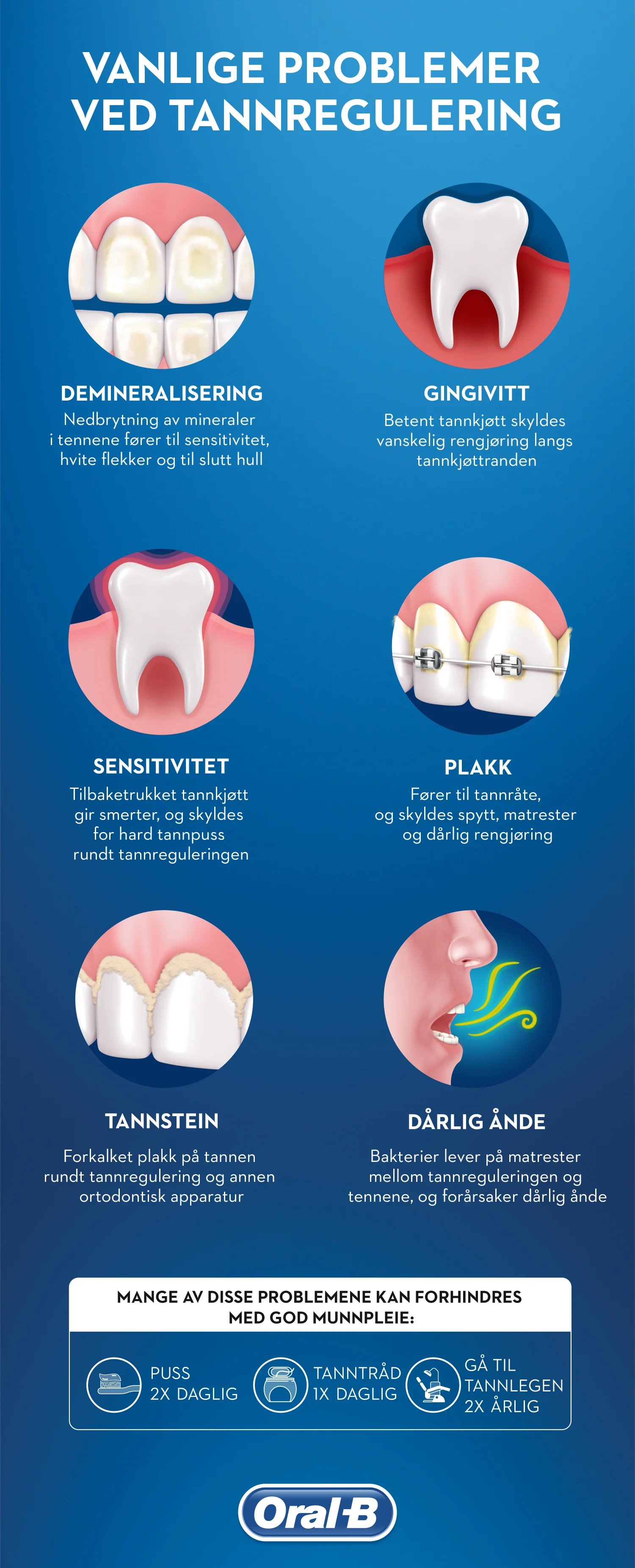 Grunner Til Å Bruke Tannregulering - Image 4 