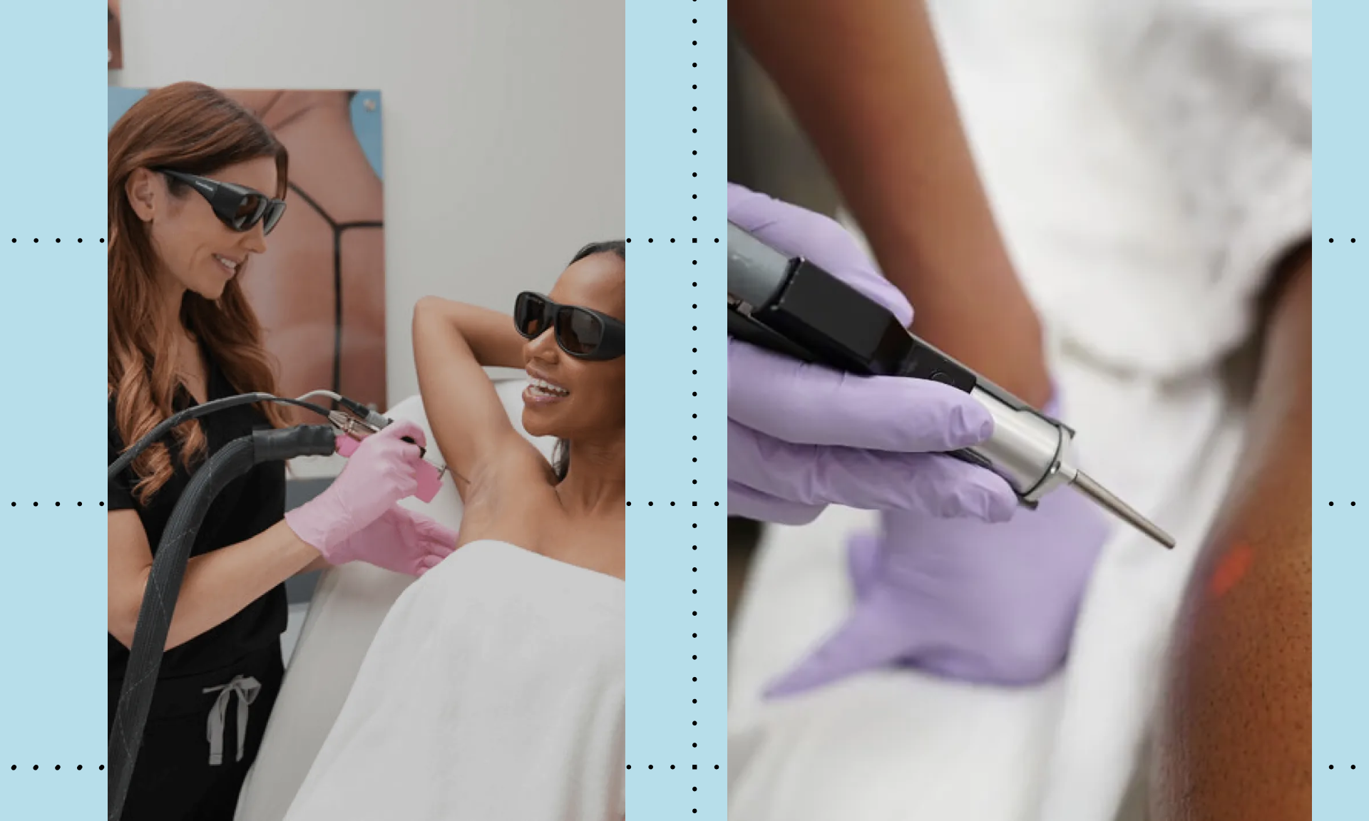 laseraway laser hair removal review