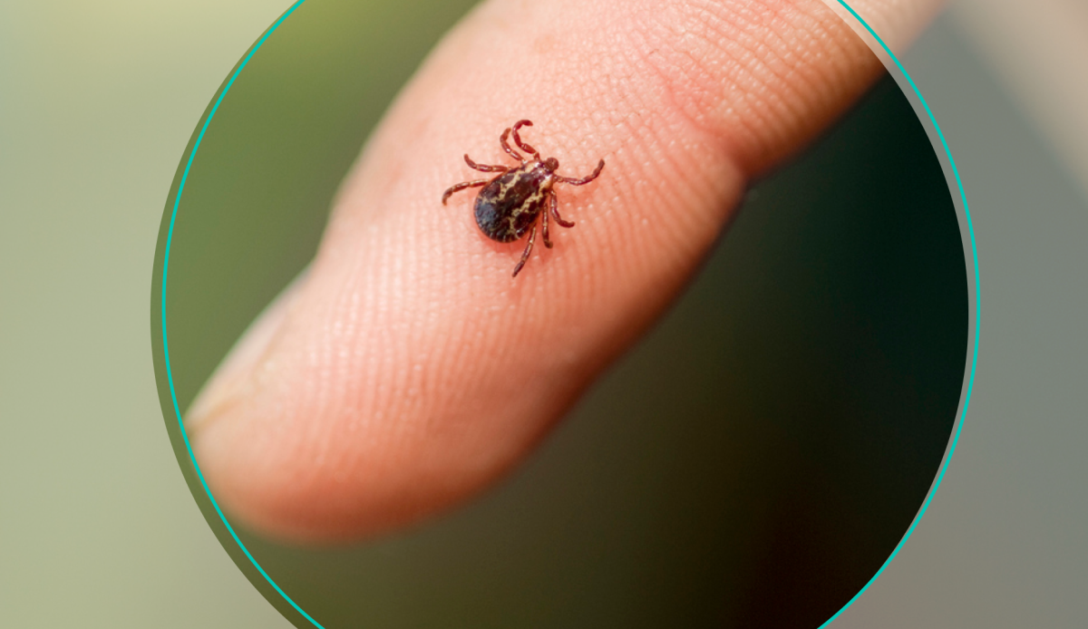 tick-bite-101-symptoms-treatment-and-prevention-theskimm