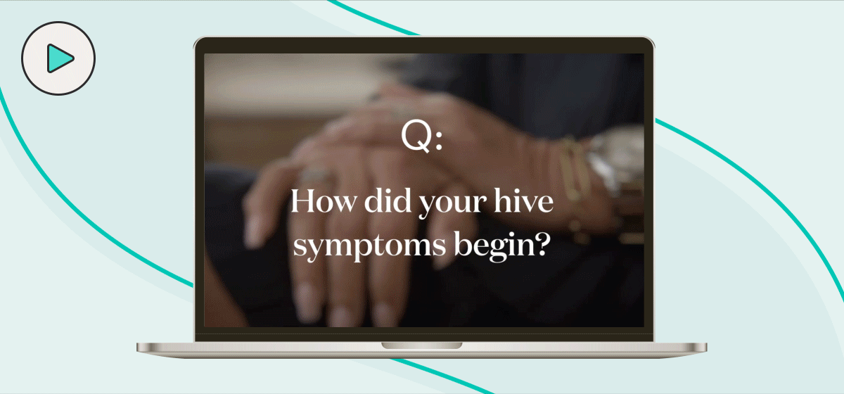 Q: How did your hive symptoms begin?