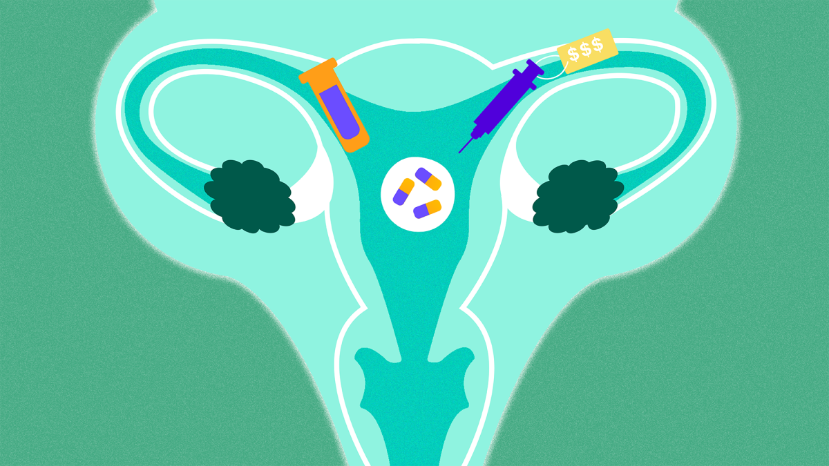 The Costs Of Fertility Treatments Theskimm