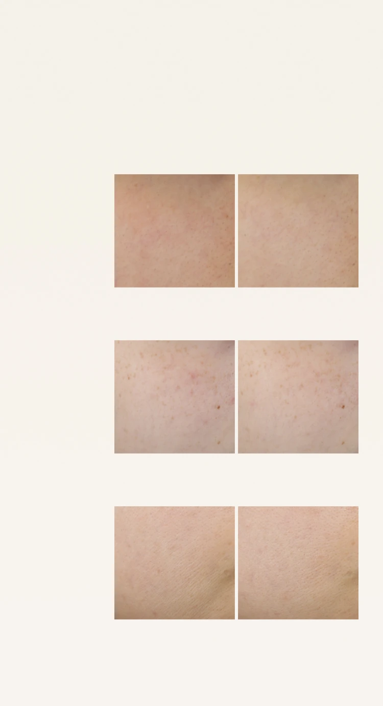 PBC - Skin Chart - BG Image