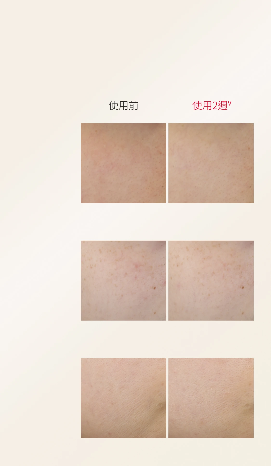 FTE - Skin Chart - BG Image