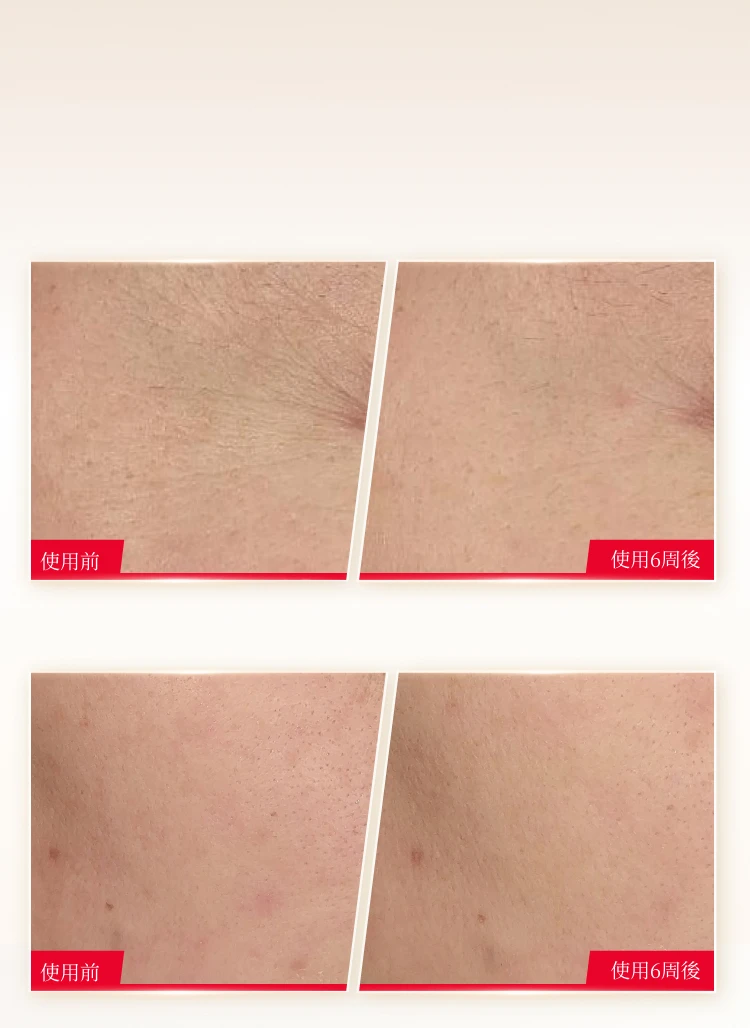 PED - Selene FTS - Skin Layer Differences - BG Image