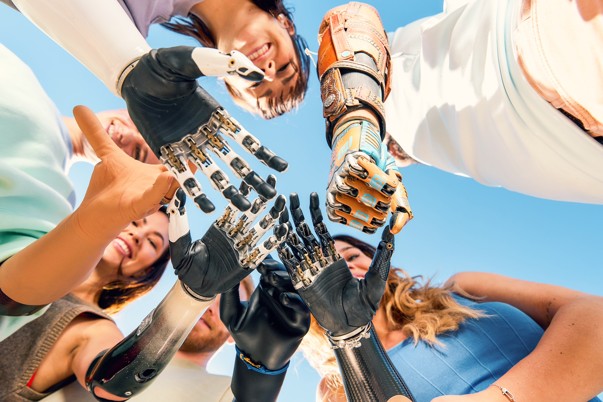 Upper limb protheses user build a circle with their hands.