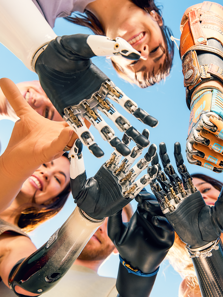 Ottobock Anwender mit Handprothesen im Kreis stehend.