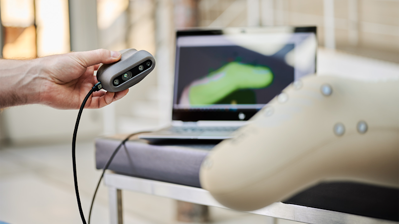 3D-Scan of the lower limb for MyFit TT socket